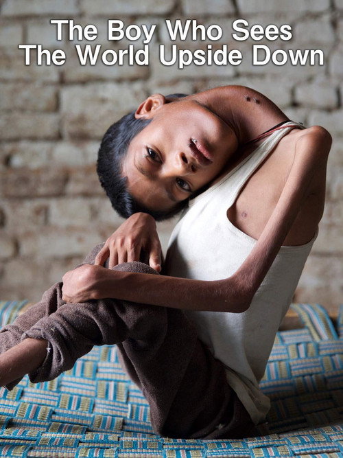 The Boy Who Sees Upside Down