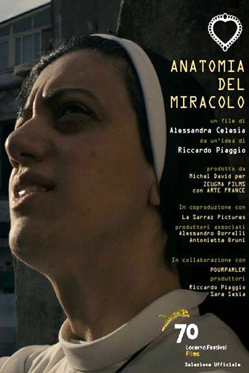 The Anatomy of a Miracle